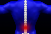 What is Spinal Stenosis?